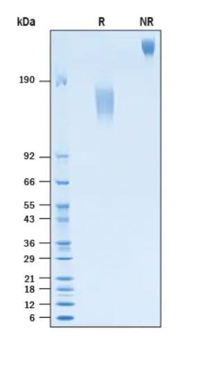 2 μg/lane Protein  was resolved with SDS-PAGE under reducing (R) and non-reducing (NR) conditions and visualized by Coomassie® Blue staining.